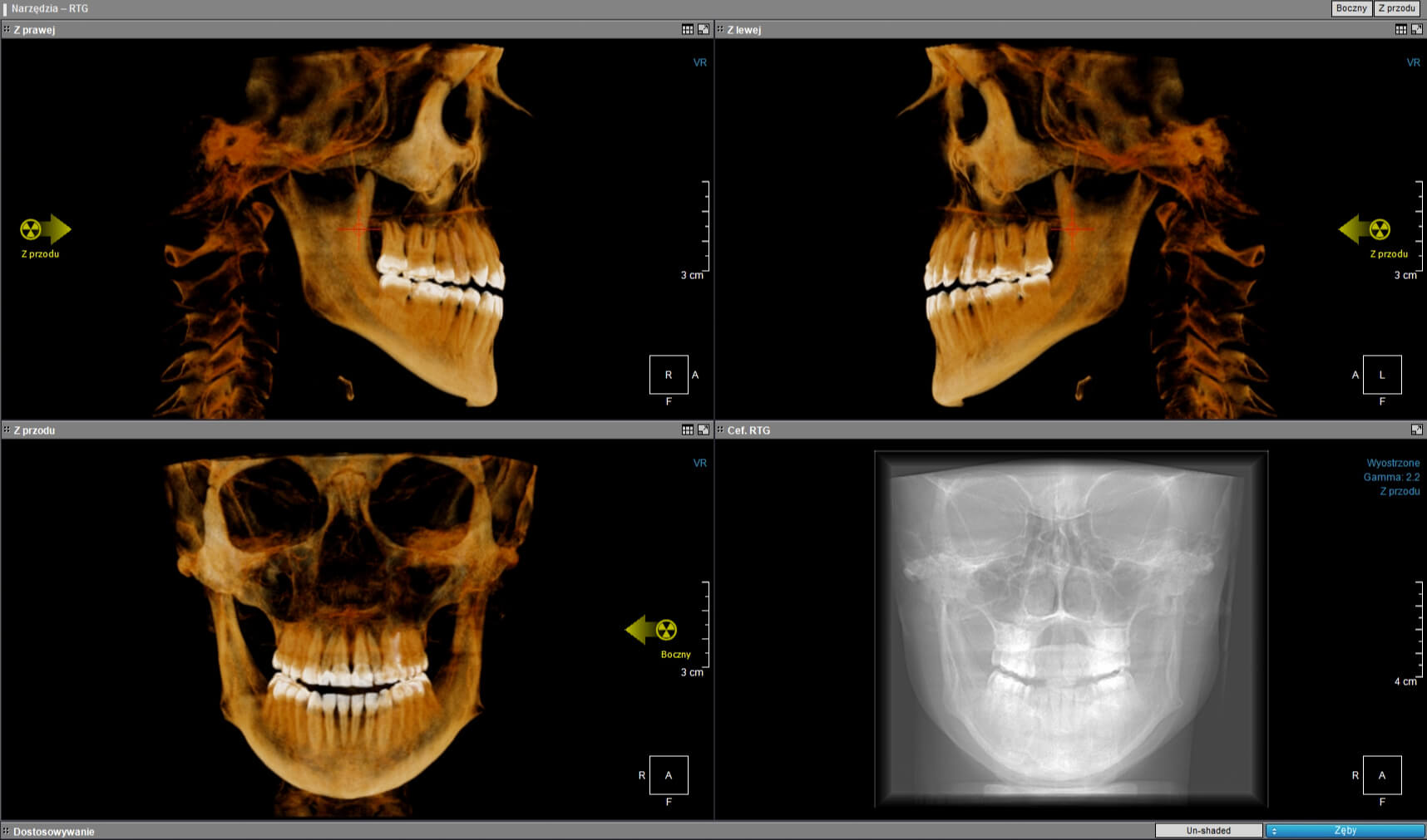 RTG zębów, pantomogram i tomografia Lublin
