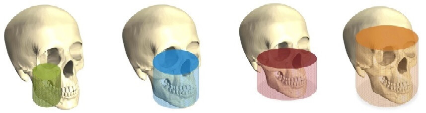 RTG zębów, pantomogram i tomografia Lublin